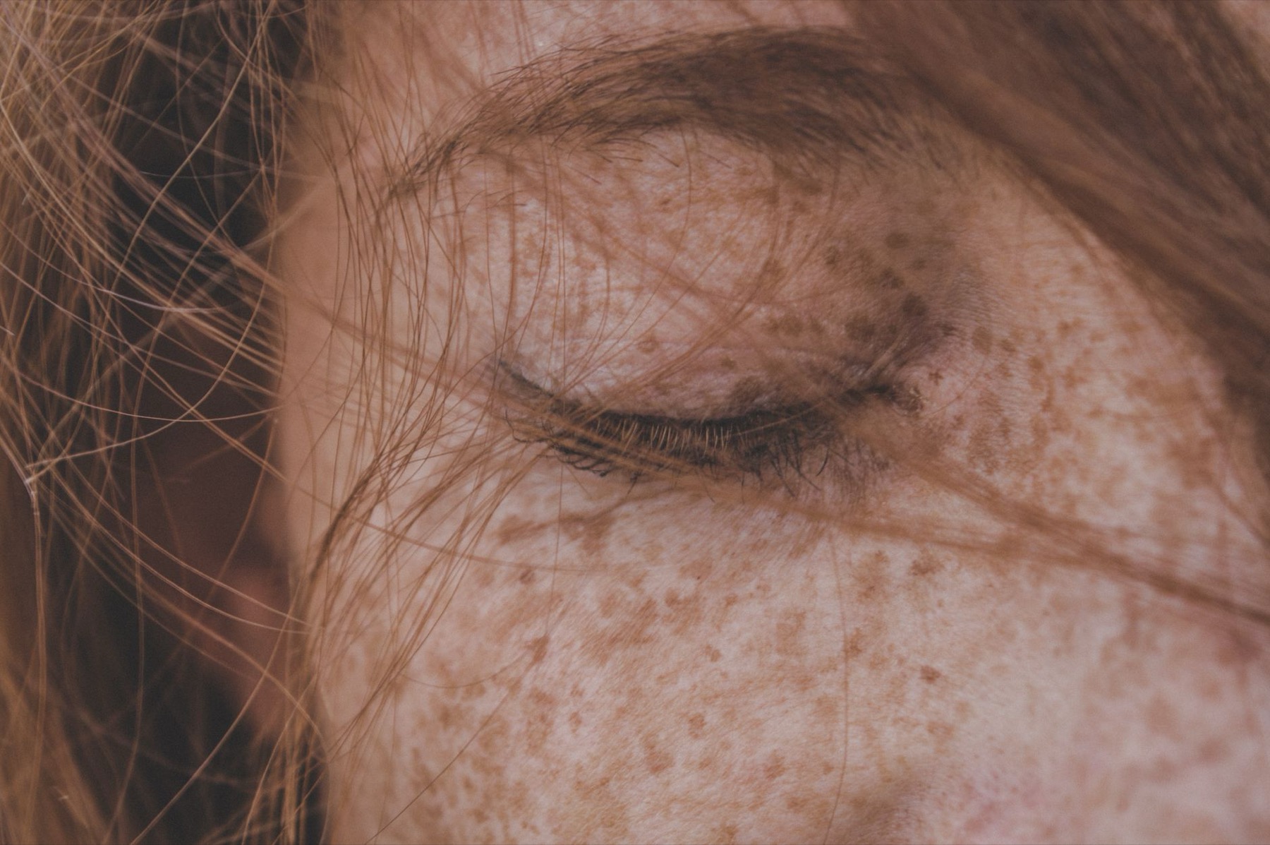 Sommersprossen im Gesicht, nahe Aufnahme